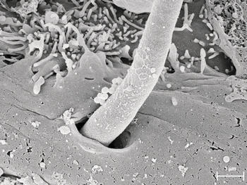 カンジダ菌について | かわせカイロプラクティック